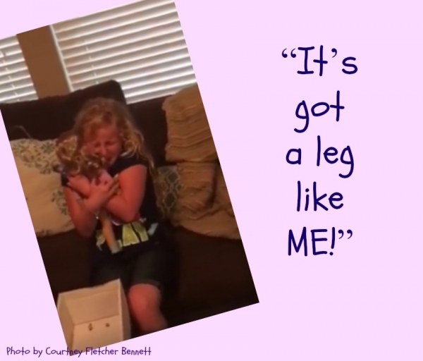 American Girl Doll with a Prosthetic Leg Makes The Whole World Cry